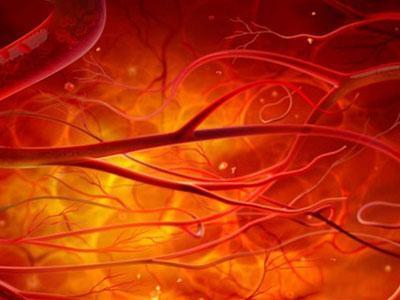 银屑病药物还可以减少主动脉炎